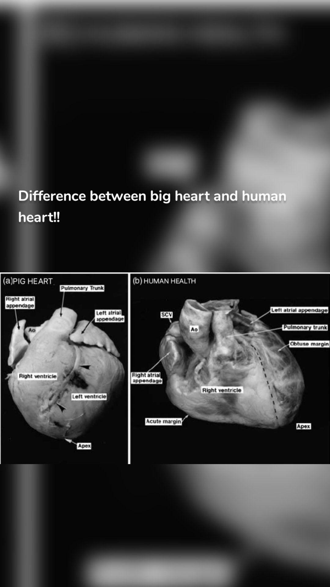 Difference between big heart and human heart!!